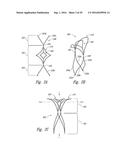 SYSTEMS AND METHODS FOR ENCLOSING AN ANATOMICAL OPENING diagram and image