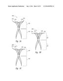 SYSTEMS AND METHODS FOR ENCLOSING AN ANATOMICAL OPENING diagram and image