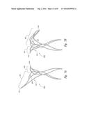 SYSTEMS AND METHODS FOR ENCLOSING AN ANATOMICAL OPENING diagram and image