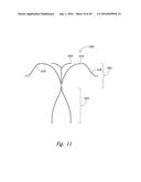 SYSTEMS AND METHODS FOR ENCLOSING AN ANATOMICAL OPENING diagram and image