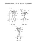 SYSTEMS AND METHODS FOR ENCLOSING AN ANATOMICAL OPENING diagram and image