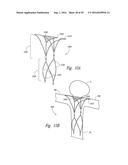 SYSTEMS AND METHODS FOR ENCLOSING AN ANATOMICAL OPENING diagram and image