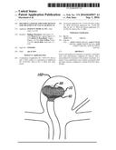 MULTIPLE LAYER FILAMENTARY DEVICES FOR TREATMENT OF VASCULAR DEFECTS diagram and image