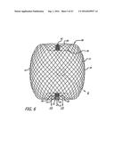 MULTIPLE LAYER FILAMENTARY DEVICES FOR TREATMENT OF VASCULAR DEFECTS diagram and image