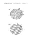 MULTIPLE LAYER FILAMENTARY DEVICES FOR TREATMENT OF VASCULAR DEFECTS diagram and image