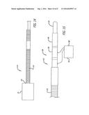 MULTIPLE LAYER FILAMENTARY DEVICES FOR TREATMENT OF VASCULAR DEFECTS diagram and image