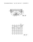 MULTIPLE LAYER FILAMENTARY DEVICES FOR TREATMENT OF VASCULAR DEFECTS diagram and image