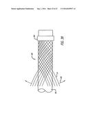 MULTIPLE LAYER FILAMENTARY DEVICES FOR TREATMENT OF VASCULAR DEFECTS diagram and image