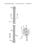 MULTIPLE LAYER FILAMENTARY DEVICES FOR TREATMENT OF VASCULAR DEFECTS diagram and image