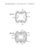 MULTIPLE LAYER FILAMENTARY DEVICES FOR TREATMENT OF VASCULAR DEFECTS diagram and image