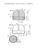 MULTIPLE LAYER FILAMENTARY DEVICES FOR TREATMENT OF VASCULAR DEFECTS diagram and image