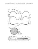 MULTIPLE LAYER FILAMENTARY DEVICES FOR TREATMENT OF VASCULAR DEFECTS diagram and image