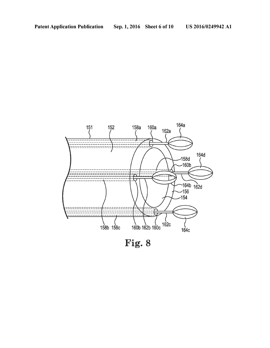 INSERTABLE MEDICAL DEVICE SYSTEM WITH PLAQUE TREATMENT PORTION AND METHODS     OF USING - diagram, schematic, and image 07