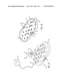 FLUID-JET DISSECTION SYSTEM AND METHOD FOR REDUCING THE APPEARANCE OF     CELLULITE diagram and image