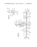 FLUID-JET DISSECTION SYSTEM AND METHOD FOR REDUCING THE APPEARANCE OF     CELLULITE diagram and image