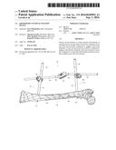 ORTHOPEDIC EXTERNAL FIXATION DEVICE diagram and image