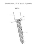 ORTHOPEDIC EXTERNAL FIXATION DEVICE diagram and image