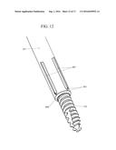 ORTHOPEDIC EXTERNAL FIXATION DEVICE diagram and image