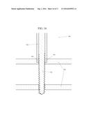 ORTHOPEDIC EXTERNAL FIXATION DEVICE diagram and image