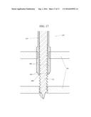 ORTHOPEDIC EXTERNAL FIXATION DEVICE diagram and image