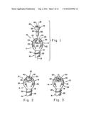 ORTHOPEDIC ANCHOR ASSEMBLY diagram and image