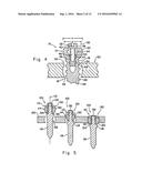 ORTHOPEDIC ANCHOR ASSEMBLY diagram and image