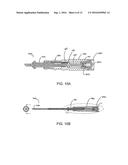 ORTHOPEDIC ANCHOR ASSEMBLY diagram and image