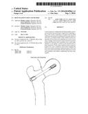 BONE FIXATION SCREW AND METHOD diagram and image