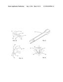 BONE FIXATION SCREW AND METHOD diagram and image