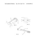 BONE FIXATION SCREW AND METHOD diagram and image