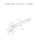 BONE FIXATION SCREW AND METHOD diagram and image