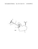 ALIGNMENT APPARATUS FOR USE IN HIP ARTHROPLASTY diagram and image