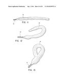 ENDOVASCULAR NEAR CRITICAL FLUID BASED CRYOABLATION CATHETER HAVING     SUPERELASTIC TREATMENT SECTION diagram and image