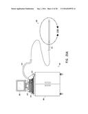 ENDOVASCULAR NEAR CRITICAL FLUID BASED CRYOABLATION CATHETER HAVING     SUPERELASTIC TREATMENT SECTION diagram and image