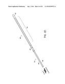 ENDOVASCULAR NEAR CRITICAL FLUID BASED CRYOABLATION CATHETER HAVING     SUPERELASTIC TREATMENT SECTION diagram and image