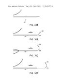 ENDOVASCULAR NEAR CRITICAL FLUID BASED CRYOABLATION CATHETER HAVING     SUPERELASTIC TREATMENT SECTION diagram and image