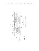 ELECTROSURGERY ARRANGEMENT, GUIDE SLEEVE AND METHOD FOR OPERATING AN     ELECTROSURGERY ARRANGEMENT diagram and image