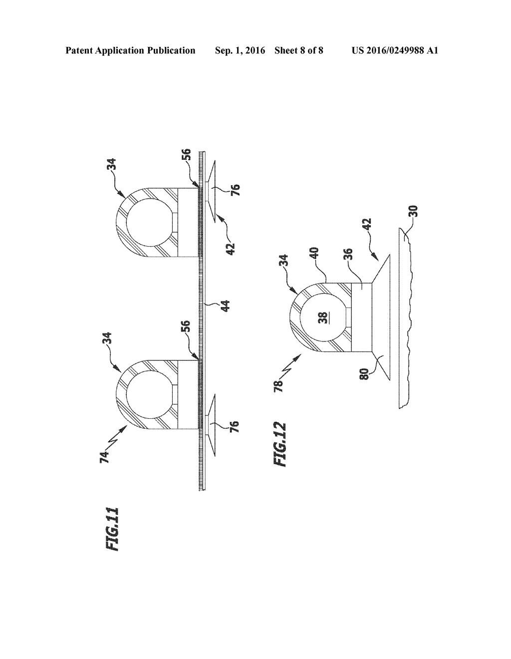 SURGICAL REFERENCING APPARATUS, SURGICAL NAVIGATION SYSTEM AND METHOD - diagram, schematic, and image 09