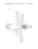 Dental Implant diagram and image