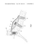 Dental Implant diagram and image