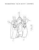 DENTAL ARTICULATORS diagram and image