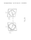 DENTAL ARTICULATORS diagram and image