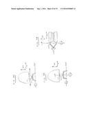 DENTAL ARTICULATORS diagram and image