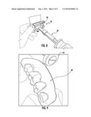 APPARATUS FOR MAKING DENTAL PROSTHESES AND RELATED METHODS diagram and image