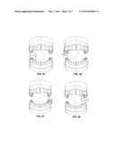 FLOSSING DEVICE WITH ASYMMETRICALLY CURVED AND BULBOUS HANDLE diagram and image