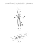 SUPPORT ASSEMBLY FOR A REPLACEMENT LIGAMENT AND ASSOCIATED METHOD diagram and image