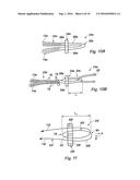 SUPPORT ASSEMBLY FOR A REPLACEMENT LIGAMENT AND ASSOCIATED METHOD diagram and image