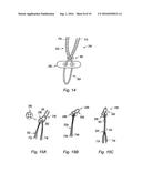 SUPPORT ASSEMBLY FOR A REPLACEMENT LIGAMENT AND ASSOCIATED METHOD diagram and image