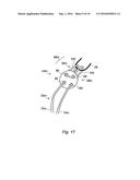 SUPPORT ASSEMBLY FOR A REPLACEMENT LIGAMENT AND ASSOCIATED METHOD diagram and image