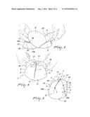 MEDICAL DEVICE FOR BREAST RECONSTRUCTION diagram and image